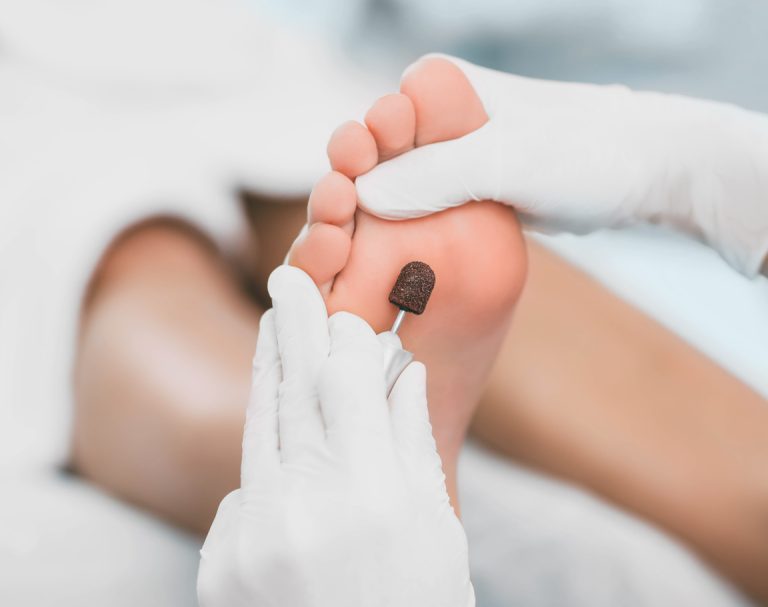 Orthopedic Treatment for Foot Wounds that Won’t Heal in Diabetes"