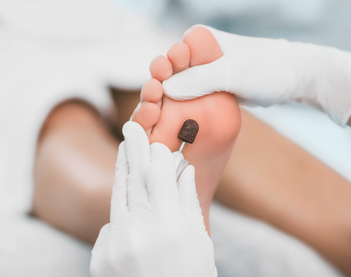 Orthopedic Treatment for Foot Wounds that Won’t Heal in Diabetes"