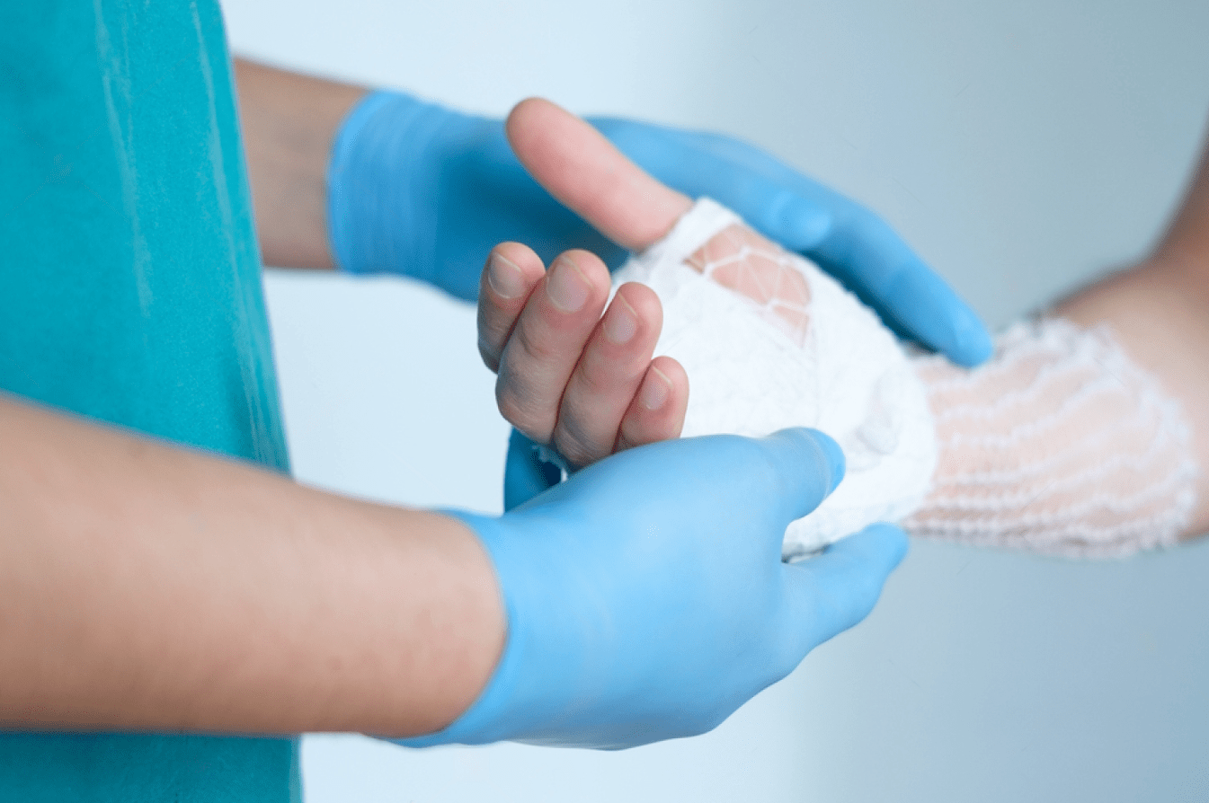 Wrist Fusion Surgery Quezon City