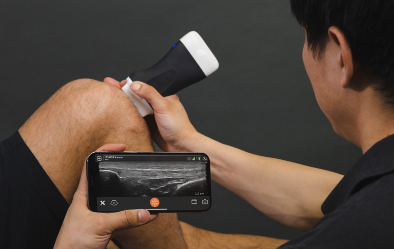 Musculoskeletal Ultrasound Imaging