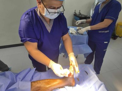 Wound Debridement Quezon City
