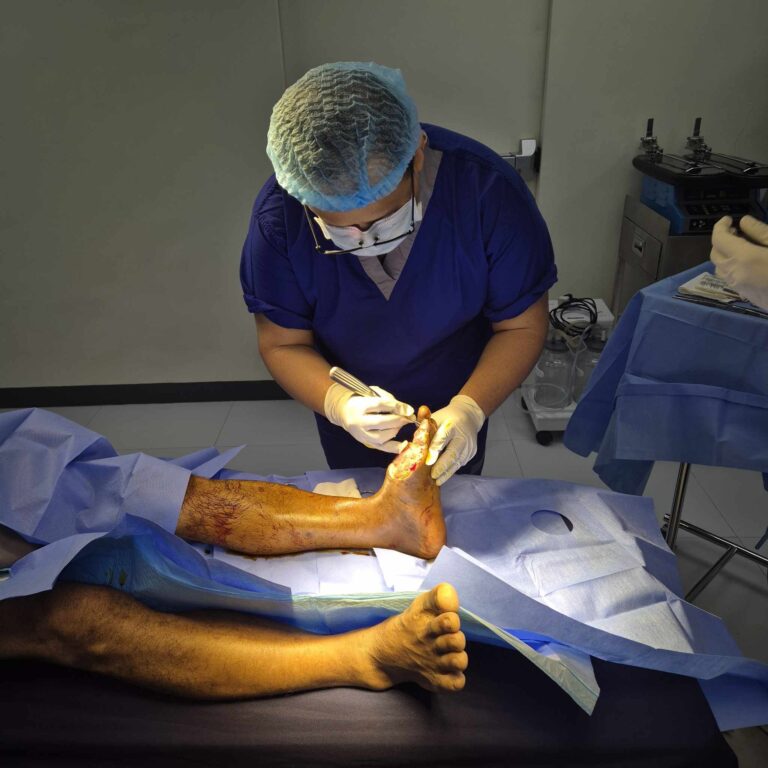 Wound Debridement Manila