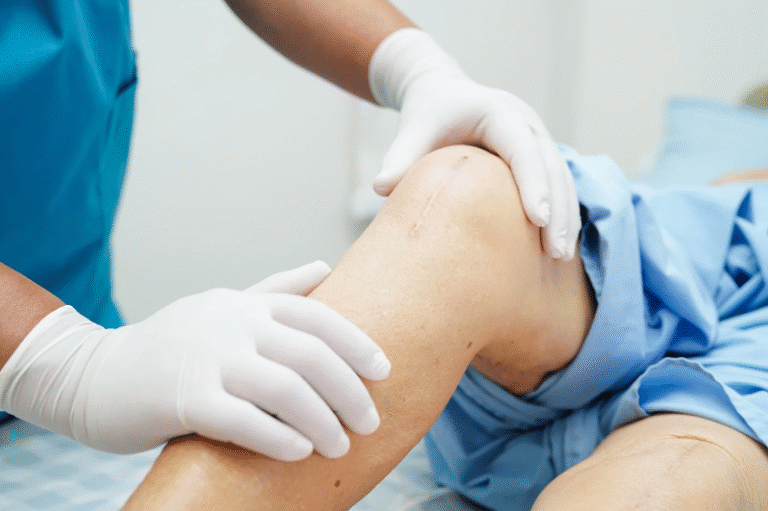 Affordable Knee Surgery How to Get Quality Care Without Breaking the Bank