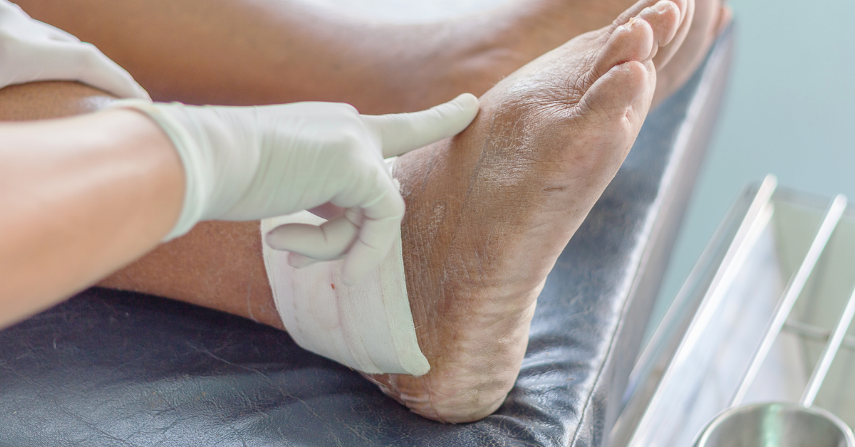 Wound Debridement Methods, Benefits, and Essential Care Insights